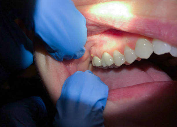Best 24-Hour Emergency Dentist in Washington Park, IL