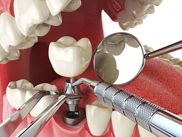 Best Emergency Treatment for Toothache in Washington Park, IL