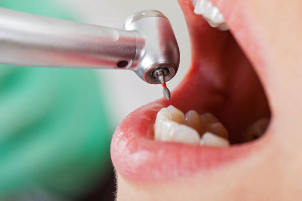 Best Emergency Dental Care for Trauma or Injury in Washington Park, IL